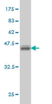 ATP6AP1 monoclonal antibody (M01), clone 3A2