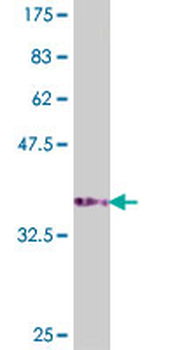 ATP6AP1 polyclonal antibody (A01)