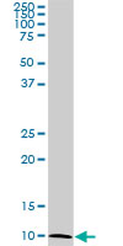 ATP6V1G2 monoclonal antibody (M02), clone 2E11
