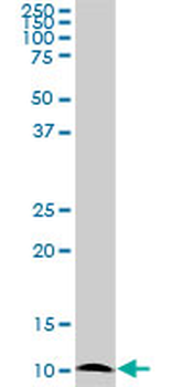ATP6V1G2 monoclonal antibody (M02), clone 2E11