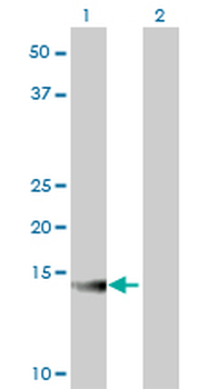 ATP6V1G2 monoclonal antibody (M02), clone 2E11