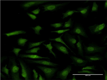 ATP6V1E1 monoclonal antibody (M02), clone 4E11