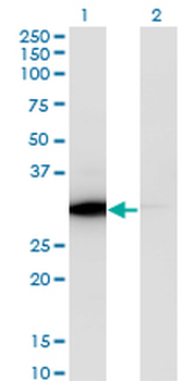 ATP6V1E1 monoclonal antibody (M02), clone 4E11