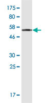 ATP6V1E1 monoclonal antibody (M02), clone 4E11