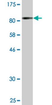 ATP6V1B2 monoclonal antibody (M05), clone 2A5