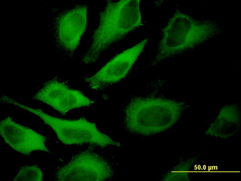ATP6V1A monoclonal antibody (M02), clone 4F5