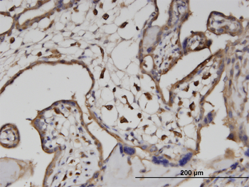 ATP6V1A monoclonal antibody (M02), clone 4F5