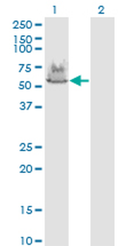 ATP6V1A monoclonal antibody (M02), clone 4F5