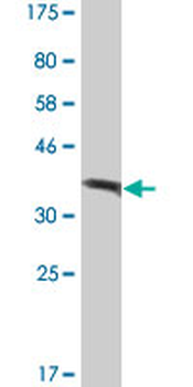 ATP6V1A monoclonal antibody (M02), clone 4F5