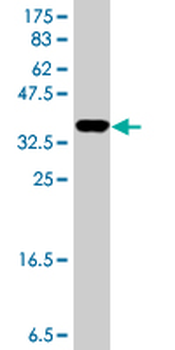 ATP6V1A polyclonal antibody (A01)
