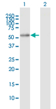 ALDH7A1 purified MaxPab mouse polyclonal antibody (B01P)