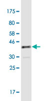 ATP2B4 monoclonal antibody (M07), clone 2G8