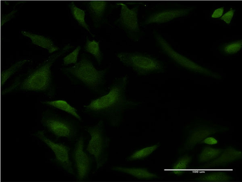 ATP2A1 monoclonal antibody (M03), clone 2C7