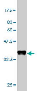 ATP2A1 monoclonal antibody (M03), clone 2C7