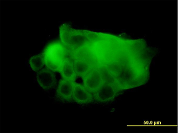 ATP2A1 monoclonal antibody (M01), clone 1B11