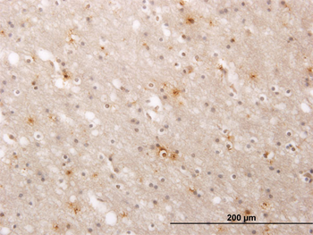 ATP2A1 monoclonal antibody (M01), clone 1B11