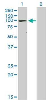 ATP2A1 monoclonal antibody (M01), clone 1B11