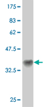 ATP2A1 monoclonal antibody (M01), clone 1B11