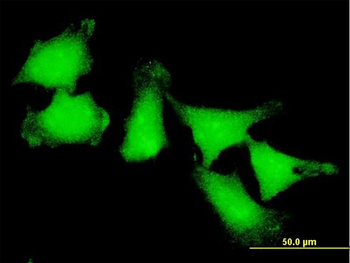 ATOX1 monoclonal antibody (M09), clone 3A1