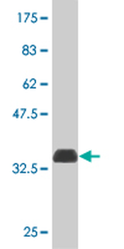ATOX1 monoclonal antibody (M09), clone 3A1
