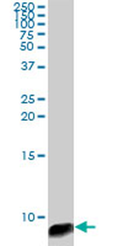 ATOX1 monoclonal antibody (M08), clone 4D6