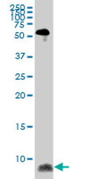 ATOX1 monoclonal antibody (M08), clone 4D6