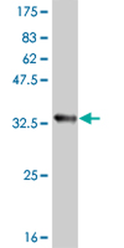 ATOX1 monoclonal antibody (M08), clone 4D6