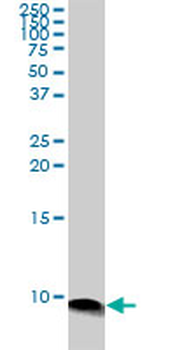 ATOX1 monoclonal antibody (M04), clone 3G11