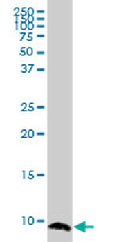 ATOX1 monoclonal antibody (M04), clone 3G11