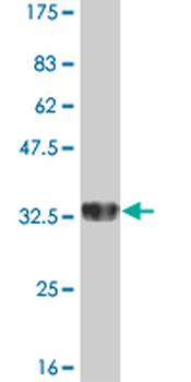 ATOX1 monoclonal antibody (M04), clone 3G11