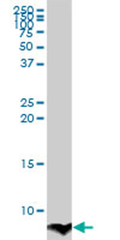 ATOX1 monoclonal antibody (M02), clone 3A2