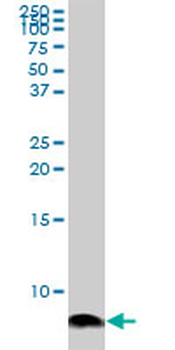 ATOX1 monoclonal antibody (M02), clone 3A2