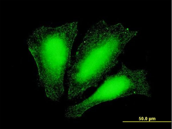 ATOX1 monoclonal antibody (M02), clone 3A2