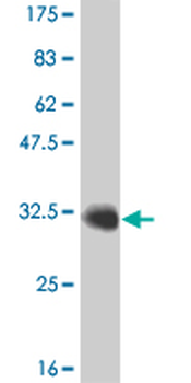 ATOX1 monoclonal antibody (M02), clone 3A2
