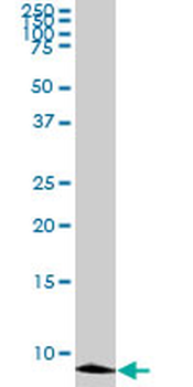 ATOX1 monoclonal antibody (M01), clone 2E6