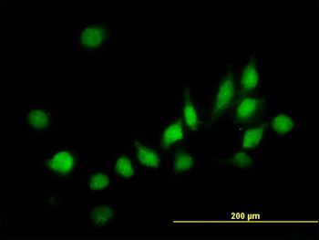 ATOX1 monoclonal antibody (M01), clone 2E6