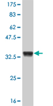 ATOX1 monoclonal antibody (M01), clone 2E6