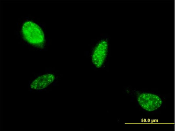 ATOH1 monoclonal antibody (M01), clone 1B12