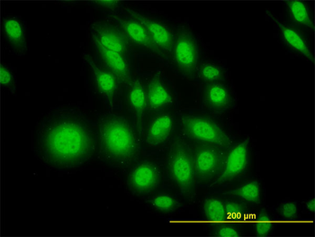 ATF4 monoclonal antibody (M01), clone 2B3