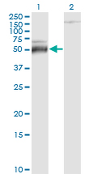 ATF4 monoclonal antibody (M01), clone 2B3