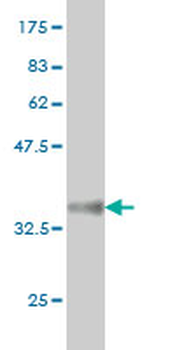ATF4 monoclonal antibody (M01), clone 2B3
