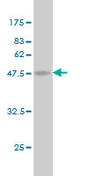 ATF3 monoclonal antibody (M07), clone 6G11