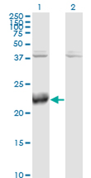ATF3 monoclonal antibody (M04), clone 8G5