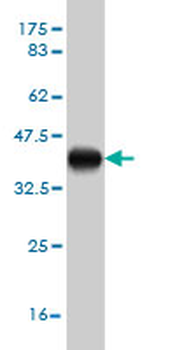 ATF3 monoclonal antibody (M04), clone 8G5