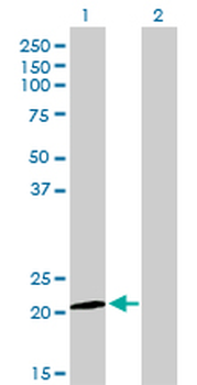 ATF3 monoclonal antibody (M01), clone 6B8