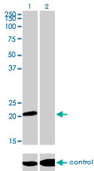 ATF3 monoclonal antibody (M01), clone 6B8