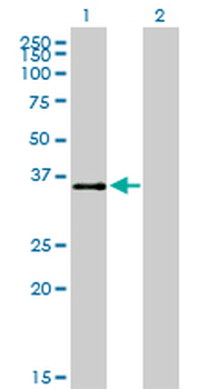 ATF1 monoclonal antibody (M03), clone 3E7