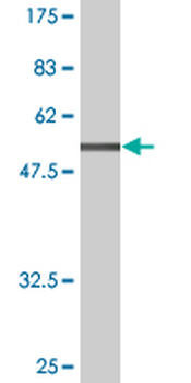 ATF1 monoclonal antibody (M03), clone 3E7