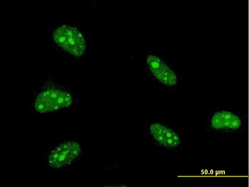 ZFHX3 monoclonal antibody (M01), clone 3B1
