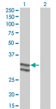SERPINC1 monoclonal antibody (M02A), clone 2B12